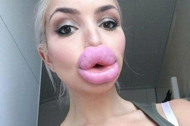 Hot B. reccomend plump lips